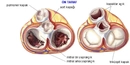 Kalbin Kapakları Nelerdir?